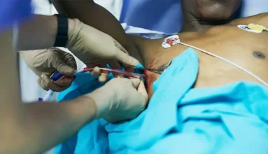The placement of chest trainage (Bulaw) tube to a patient due to accumulation of air or blood in his chest (pneumothorax or hemothorax).