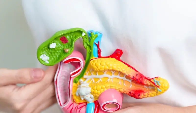 Close-up of a medical model showing the gallbladder, pancreas, and surrounding anatomy, highlighting gallstones.