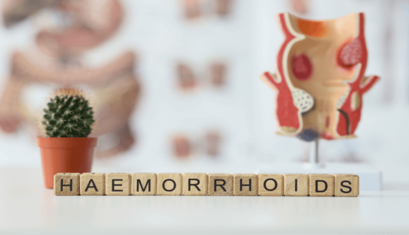 Hemorrhoid Treatment at HOMED Θεραπεία Αιμορροΐδων στην HOMED