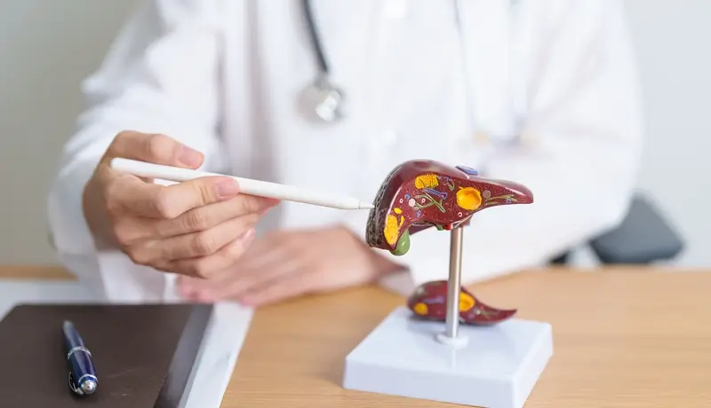 A doctor pointing at a liver model with a pen, explaining anatomical details and gallbladder-related conditions.