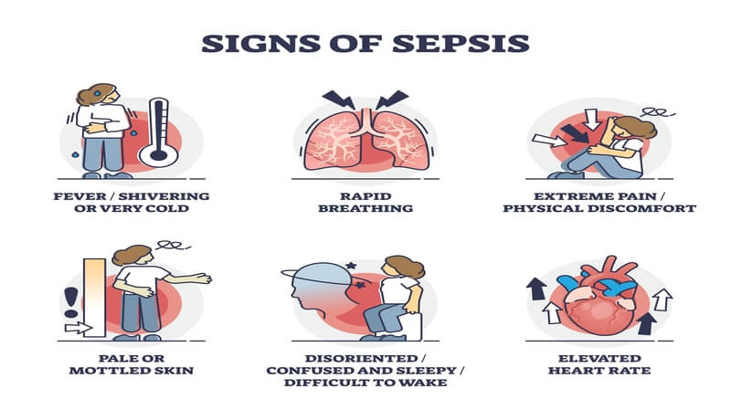 Sepsis Symptoms and Treatment
