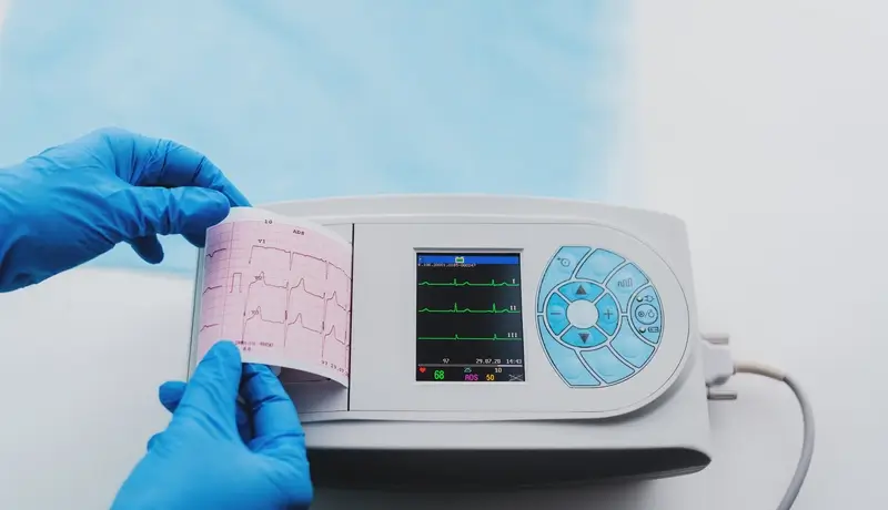 Close up view of ECG machine display and print out trip chart indicating pulse tare