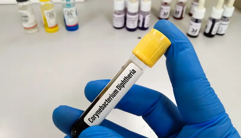 a hand holding a bottle of blood with a bar code on it saying corynebacterium