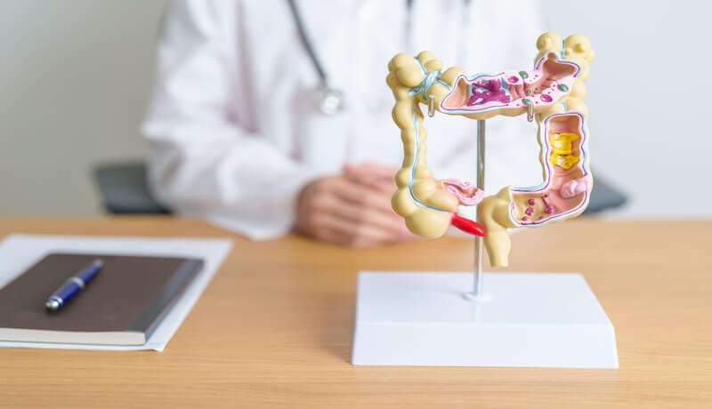 Diverticulitis causes and symptoms Συμπτώματα εκκολπωματίτιδας και θεραπεία