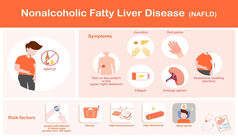 Fatty Liver Disease Management Διαχείριση Λιπώδους Ήπατος