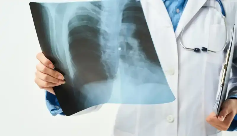 A doctor holding a chest X-ray, highlighting the ribcage and lung area for analysis.