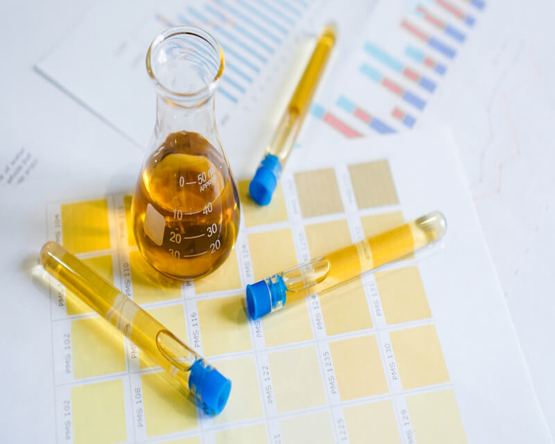 Urinalysis, urine cup with reagent strip pH paper test and comparison chart in laboratory.