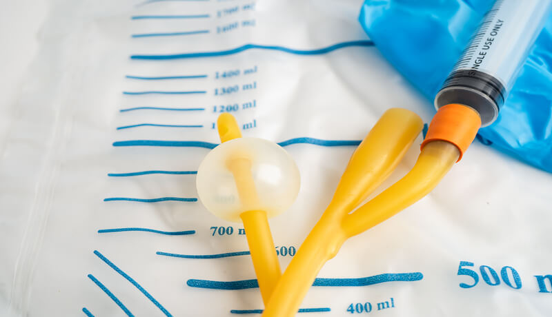 the photo shows just an urinary catheter with its balloon