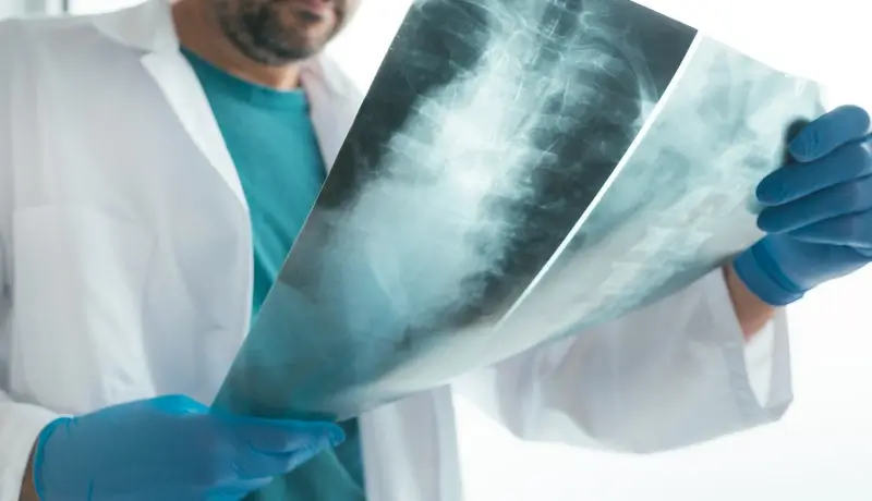 A doctor wearing gloves examining an X-ray image, focusing on the thoracic or abdominal region for diagnostic purposes.