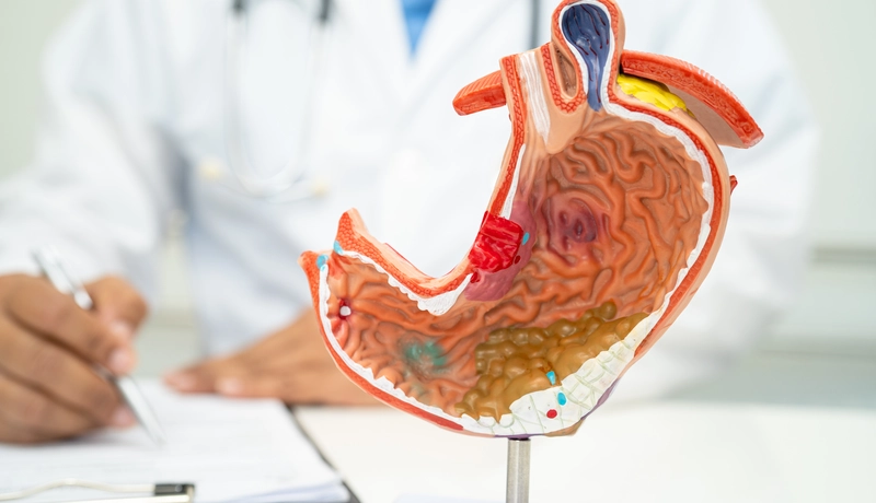 A doctor holding a detailed anatomical model of the human stomach, illustrating its internal structure and functions.
