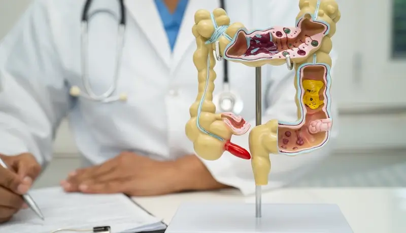 Intestine, appendix and digestive system, doctor holding anatomy model for study diagnosis