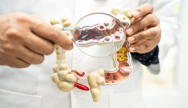 Intestine, appendix and digestive system, doctor holding anatomy model for study diagnosis