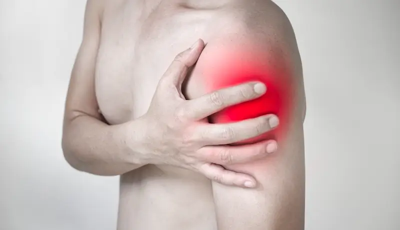 A picture that shows a man with myositis holding his arm
