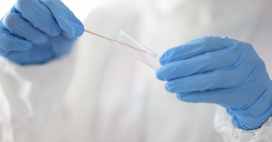 Procedure of Flu test