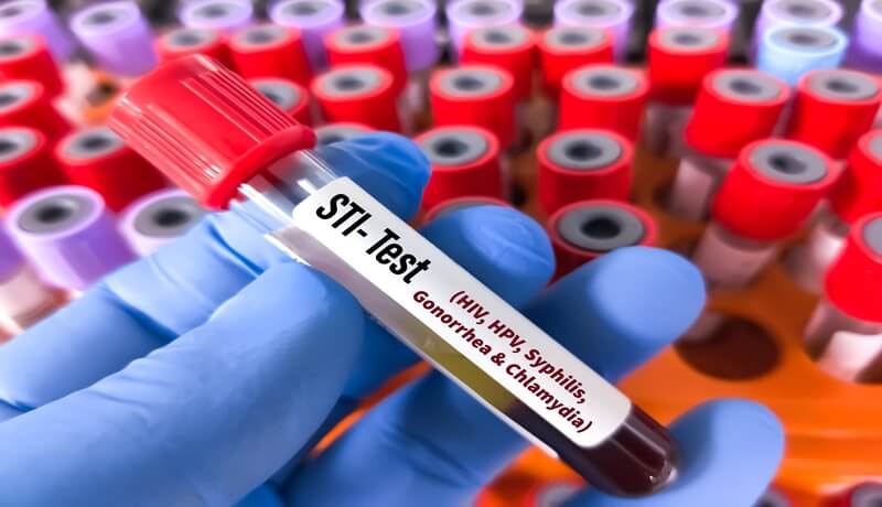 Preventing STIs effectively guide