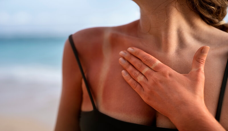 Sun Exposure Health Effects Κίνδυνοι Υγείας Ηλιοφάνειας
