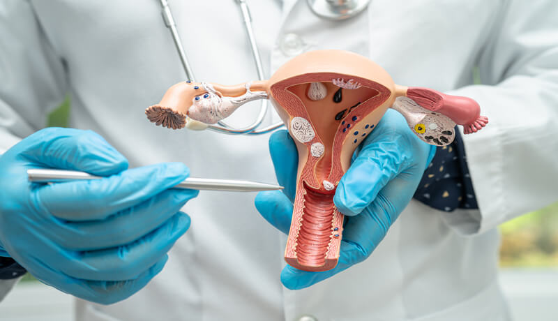 The picture shows a doctor holding aplastic uterus